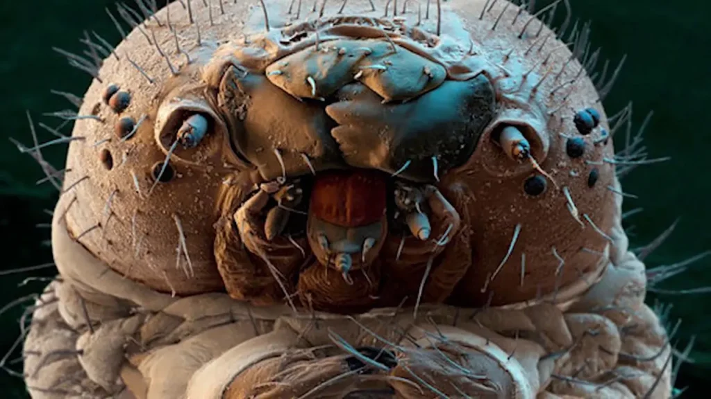 demodex akarları